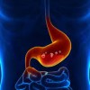胃液の色について！赤や緑、茶色の場合は危険なの？